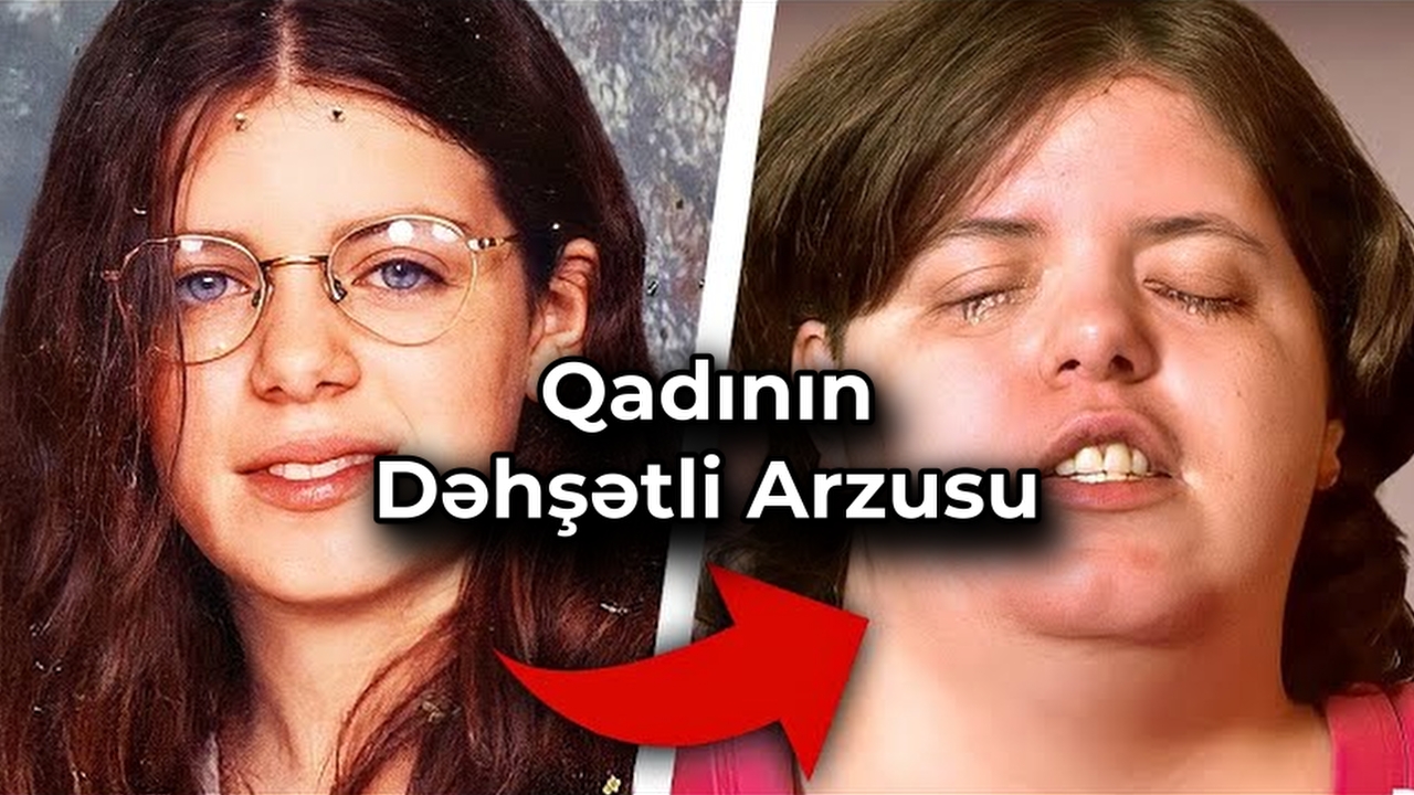 Sağlam Gözlərini Niyə Kor Etdi ?